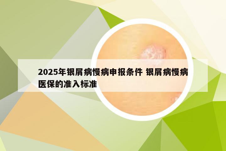 2025年银屑病慢病申报条件 银屑病慢病医保的准入标准