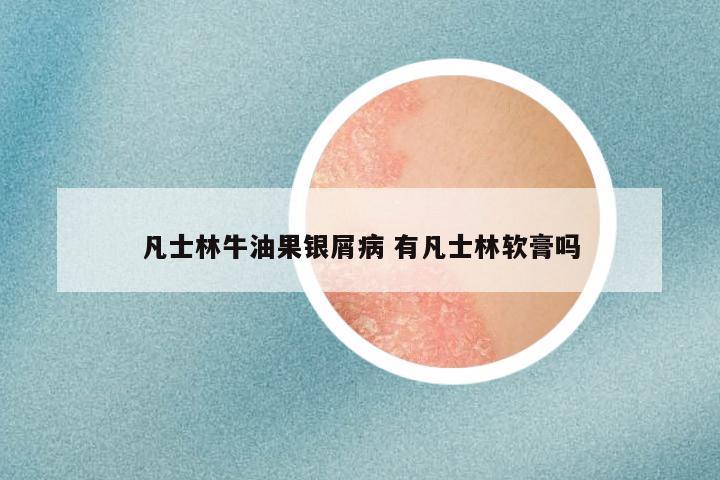 凡士林牛油果银屑病 有凡士林软膏吗