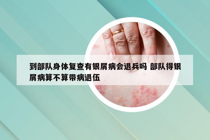 到部队身体复查有银屑病会退兵吗 部队得银屑病算不算带病退伍