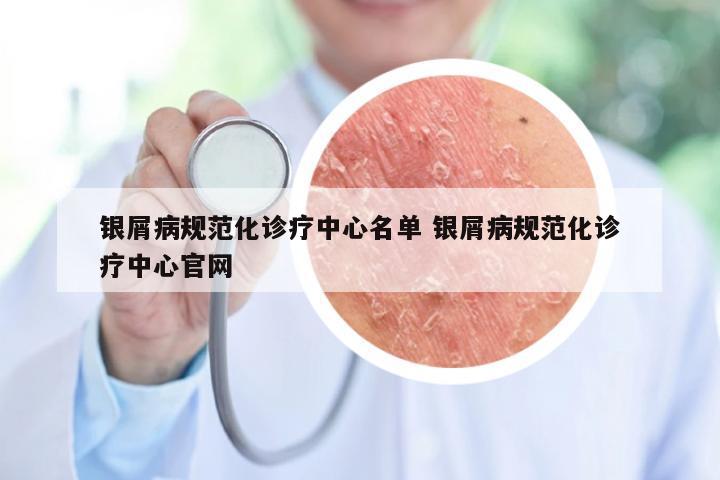 银屑病规范化诊疗中心名单 银屑病规范化诊疗中心官网