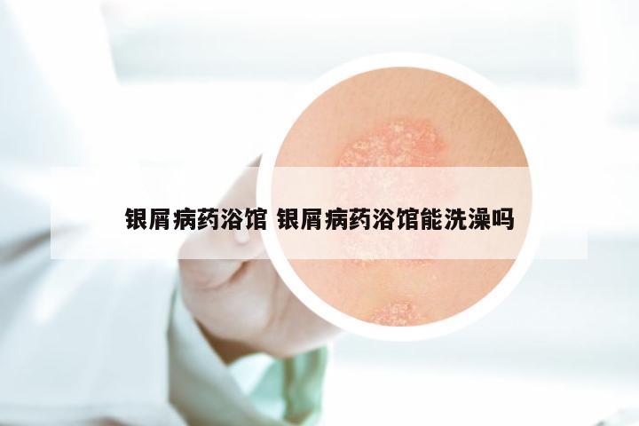 银屑病药浴馆 银屑病药浴馆能洗澡吗
