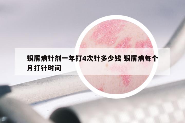 银屑病针剂一年打4次针多少钱 银屑病每个月打针时间