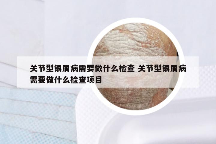 关节型银屑病需要做什么检查 关节型银屑病需要做什么检查项目
