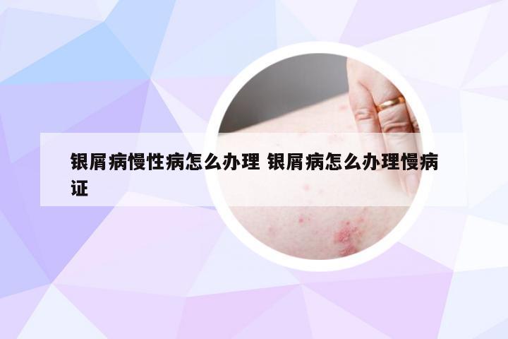 银屑病慢性病怎么办理 银屑病怎么办理慢病证