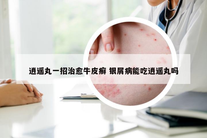 逍遥丸一招治愈牛皮癣 银屑病能吃逍遥丸吗