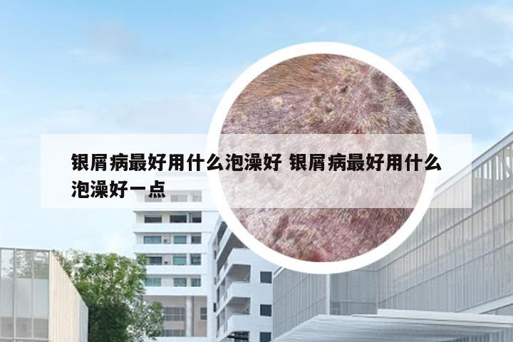 银屑病最好用什么泡澡好 银屑病最好用什么泡澡好一点