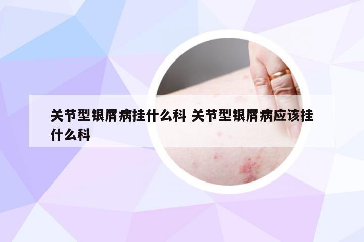 关节型银屑病挂什么科 关节型银屑病应该挂什么科