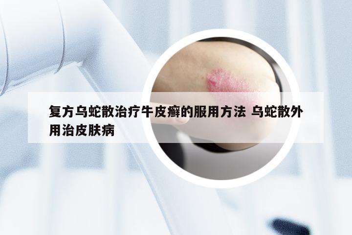 复方乌蛇散治疗牛皮癣的服用方法 乌蛇散外用治皮肤病