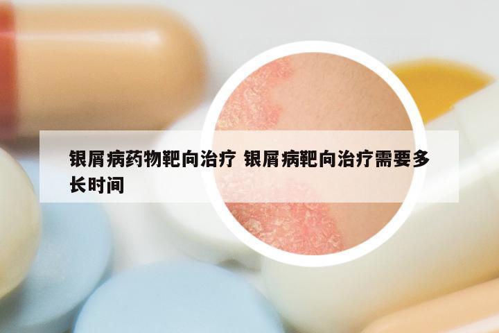 银屑病药物靶向治疗 银屑病靶向治疗需要多长时间