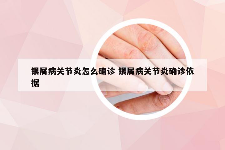 银屑病关节炎怎么确诊 银屑病关节炎确诊依据
