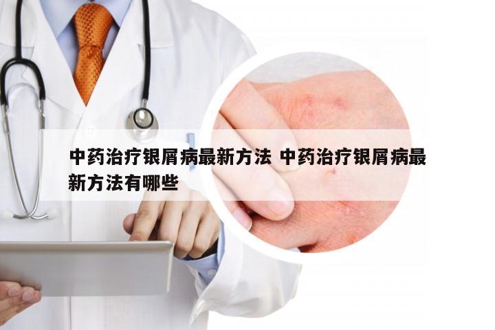 中药治疗银屑病最新方法 中药治疗银屑病最新方法有哪些