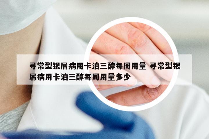 寻常型银屑病用卡泊三醇每周用量 寻常型银屑病用卡泊三醇每周用量多少