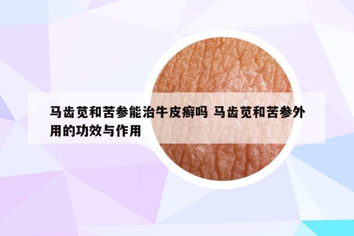 马齿苋和苦参能治牛皮癣吗 马齿苋和苦参外用的功效与作用