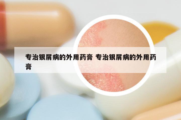 专治银屑病的外用药膏 专治银屑病的外用药膏