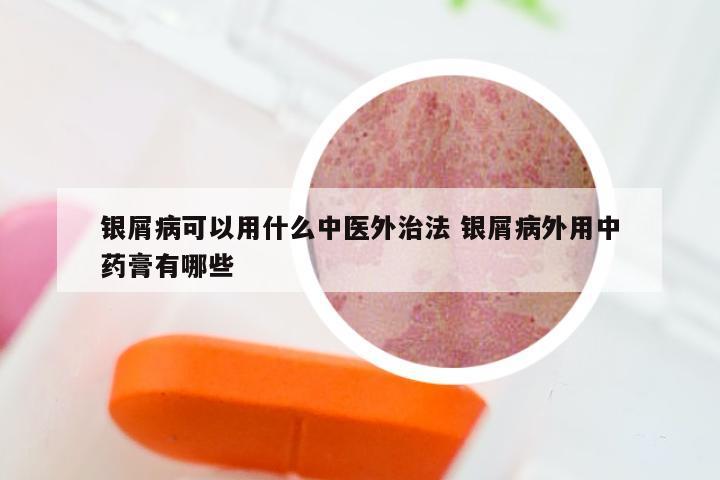 银屑病可以用什么中医外治法 银屑病外用中药膏有哪些