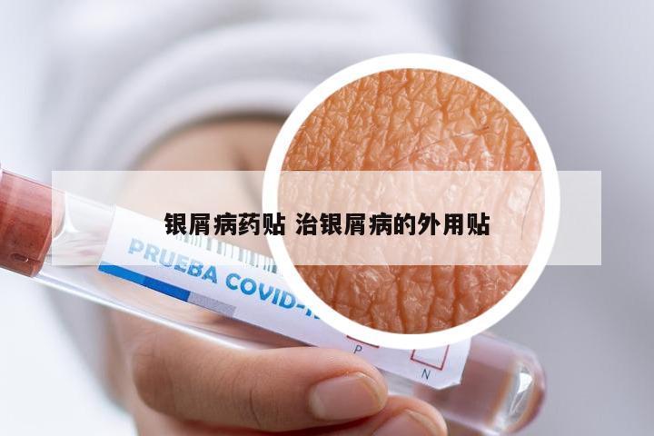 银屑病药贴 治银屑病的外用贴