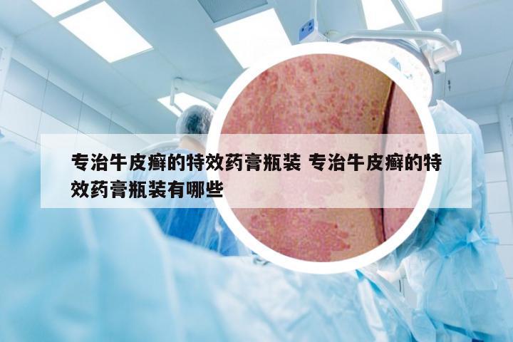专治牛皮癣的特效药膏瓶装 专治牛皮癣的特效药膏瓶装有哪些