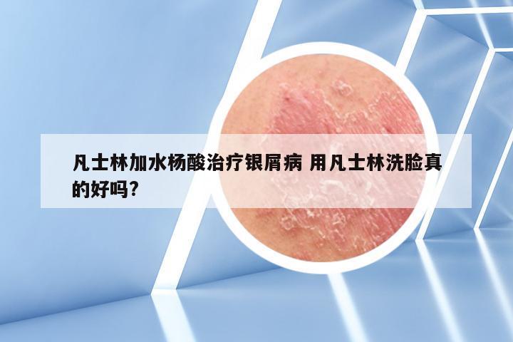 凡士林加水杨酸治疗银屑病 用凡士林洗脸真的好吗?