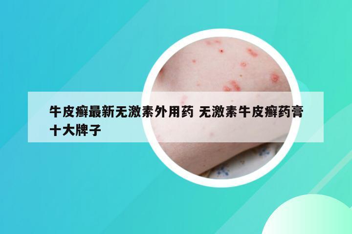 牛皮癣最新无激素外用药 无激素牛皮癣药膏十大牌子