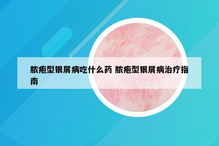 脓疱型银屑病吃什么药 脓疱型银屑病治疗指南