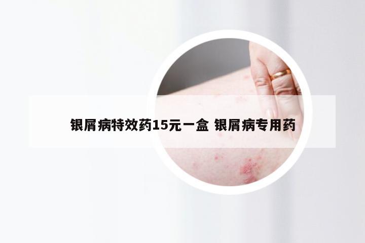 银屑病特效药15元一盒 银屑病专用药