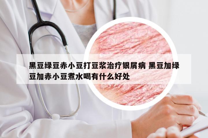黑豆绿豆赤小豆打豆浆治疗银屑病 黑豆加绿豆加赤小豆煮水喝有什么好处
