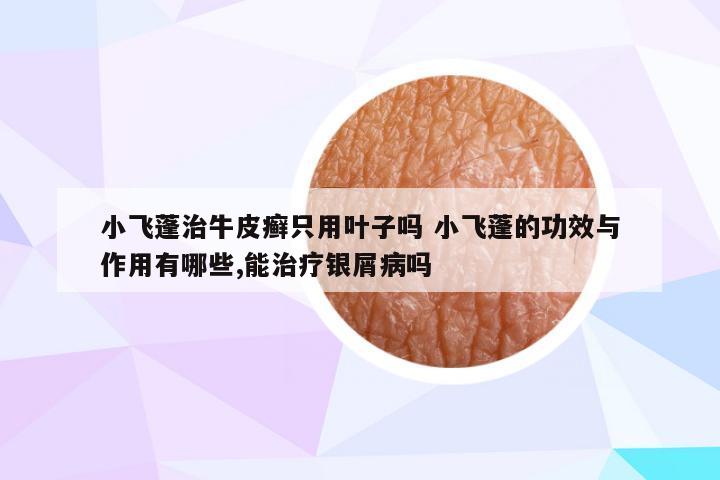 小飞蓬治牛皮癣只用叶子吗 小飞蓬的功效与作用有哪些,能治疗银屑病吗