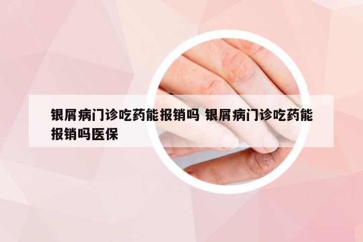 银屑病门诊吃药能报销吗 银屑病门诊吃药能报销吗医保