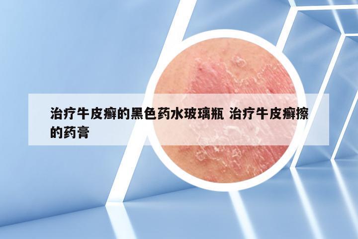 治疗牛皮癣的黑色药水玻璃瓶 治疗牛皮癣擦的药膏