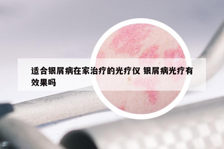 适合银屑病在家治疗的光疗仪 银屑病光疗有效果吗