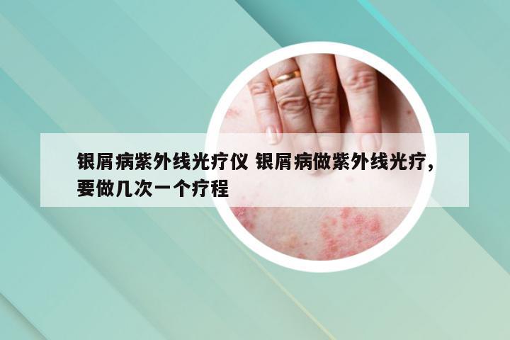 银屑病紫外线光疗仪 银屑病做紫外线光疗,要做几次一个疗程