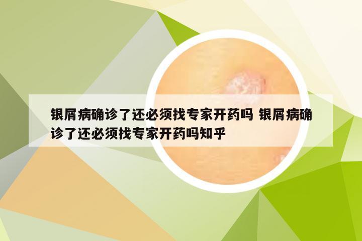 银屑病确诊了还必须找专家开药吗 银屑病确诊了还必须找专家开药吗知乎