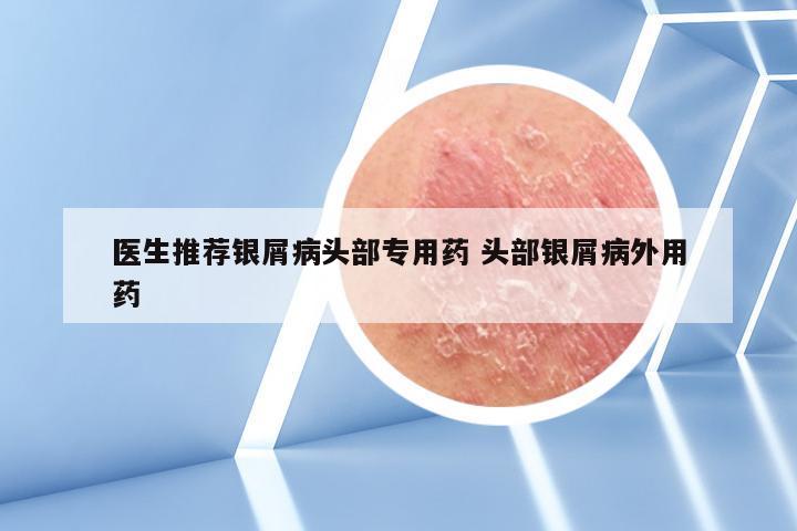医生推荐银屑病头部专用药 头部银屑病外用药