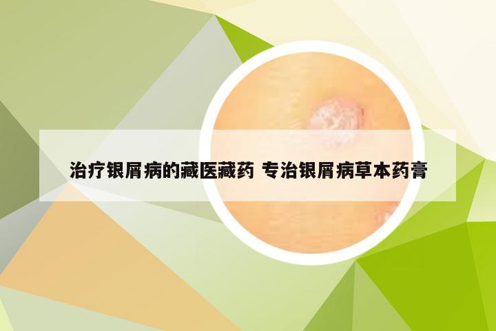 治疗银屑病的藏医藏药 专治银屑病草本药膏
