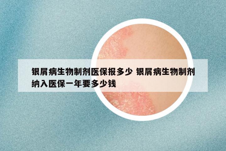 银屑病生物制剂医保报多少 银屑病生物制剂纳入医保一年要多少钱