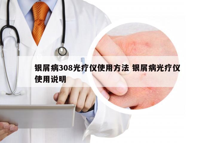 银屑病308光疗仪使用方法 银屑病光疗仪使用说明