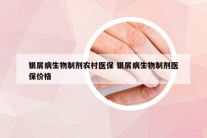 银屑病生物制剂农村医保 银屑病生物制剂医保价格