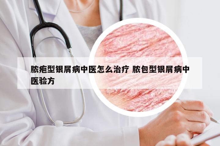 脓疱型银屑病中医怎么治疗 脓包型银屑病中医验方