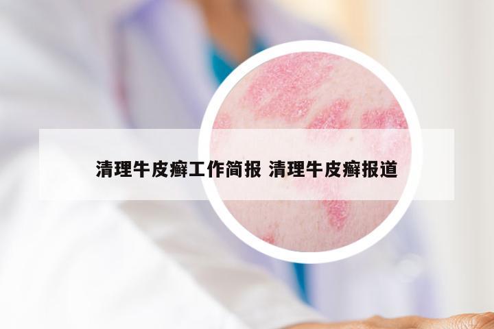 清理牛皮癣工作简报 清理牛皮癣报道