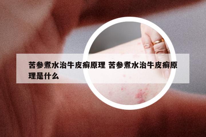 苦参煮水治牛皮癣原理 苦参煮水治牛皮癣原理是什么