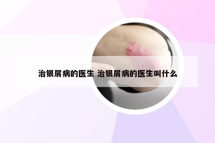 治银屑病的医生 治银屑病的医生叫什么