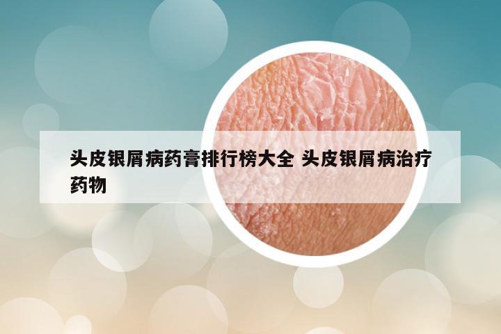 头皮银屑病药膏排行榜大全 头皮银屑病治疗药物