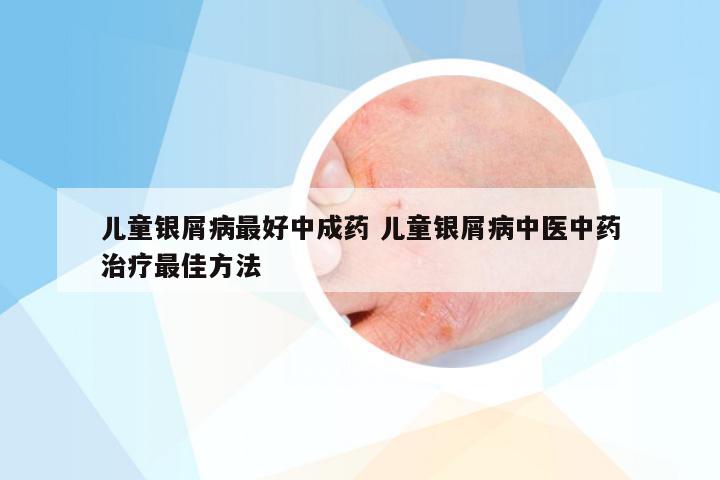 儿童银屑病最好中成药 儿童银屑病中医中药治疗最佳方法