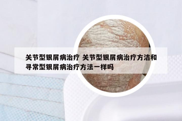 关节型银屑病治疗 关节型银屑病治疗方洁和寻常型银屑病治疗方法一样吗