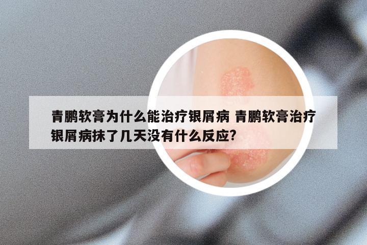 青鹏软膏为什么能治疗银屑病 青鹏软膏治疗银屑病抹了几天没有什么反应?