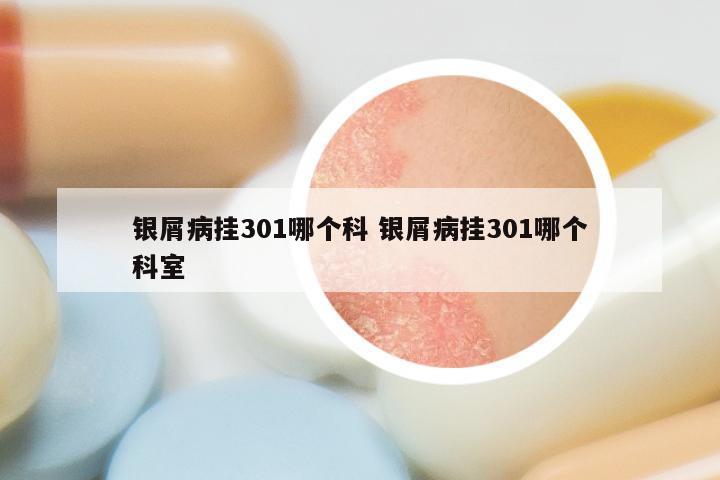 银屑病挂301哪个科 银屑病挂301哪个科室
