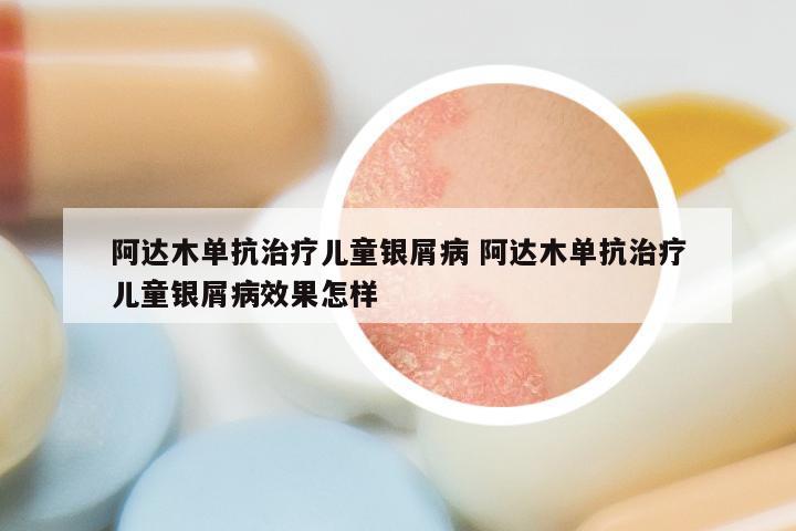 阿达木单抗治疗儿童银屑病 阿达木单抗治疗儿童银屑病效果怎样
