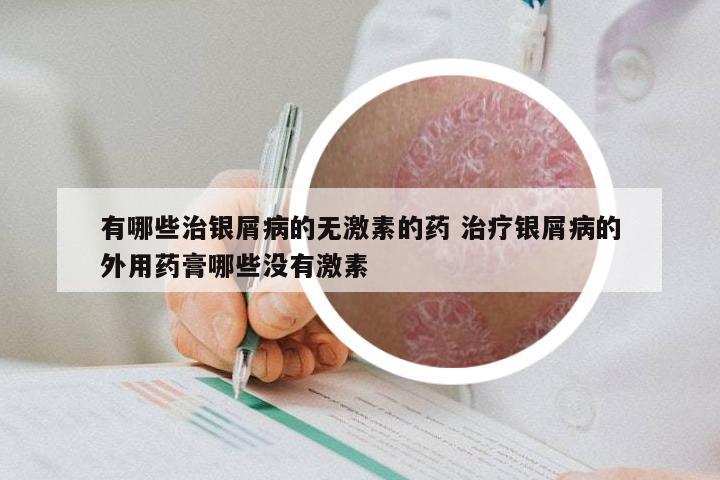 有哪些治银屑病的无激素的药 治疗银屑病的外用药膏哪些没有激素