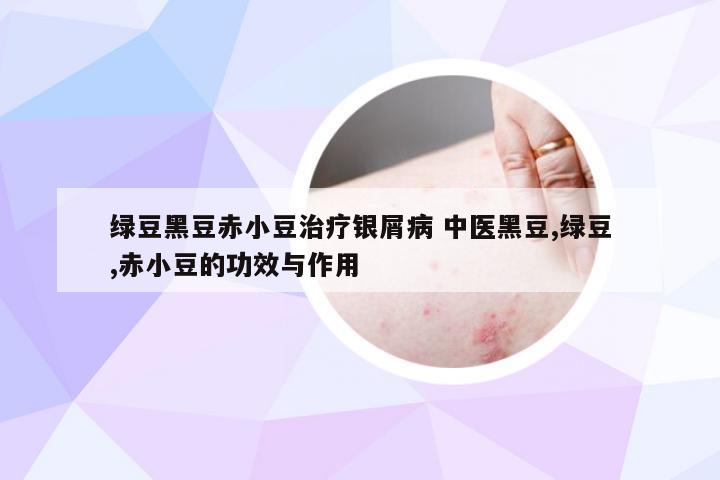 绿豆黑豆赤小豆治疗银屑病 中医黑豆,绿豆,赤小豆的功效与作用