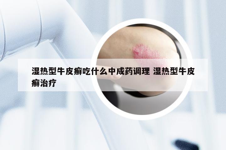 湿热型牛皮癣吃什么中成药调理 湿热型牛皮癣治疗